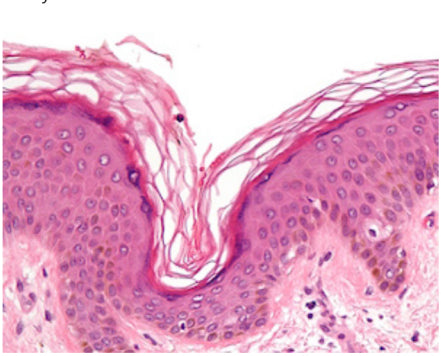 Peptide Image